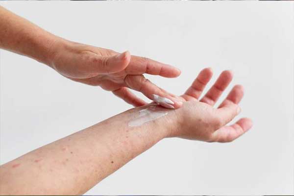 علاج حساسية الجلد والهرش مرهم