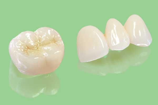 أنواع تلبيسات الأسنان وافضلها