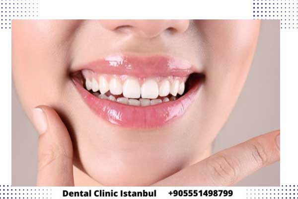تقنيات علاج الاسنان في تركيا – مميزات وعيوب و أسعار