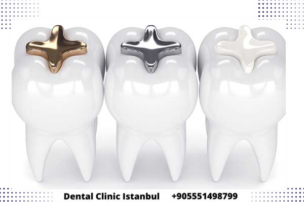 حشو الأسنان في تركيا – اختر حشوة الأسنان المناسبة لك