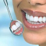 Differences between Veneers and Lumineers Dental Veneers