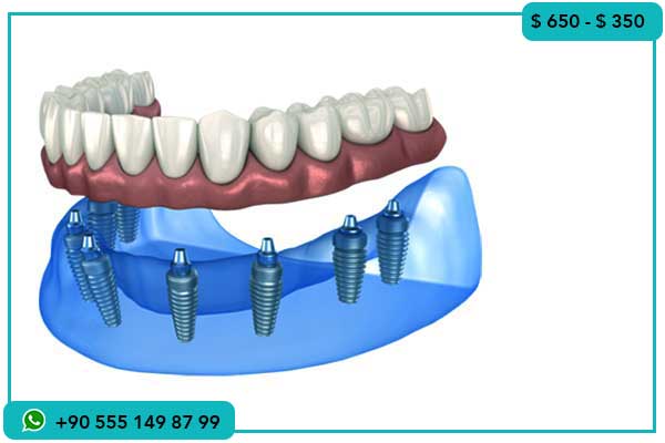 أسعار زراعة الأسنان في الجزائر , الفرق بين أسعار زراعة الأسنان في الجزائر وتركيا, لماذا تختار تركيا لزراعة الأسنان, أسعار زراعة الأسنان في الجزائر, تكلفة زراعة الأسنان في تركيا, زراعة الأسنان في تركيا بأسعار منخفضة, تجارب زراعة الأسنان في تركيا, مقارنة زراعة الأسنان الجزائر تركيا, زراعة الأسنان في تركيا والسياحة العلاجية, زراعة الأسنان مع أفضل الأطباء في تركيا, خدمات زراعة الأسنان في تركيا , زراعة الأسنان, زراعة الأسنان في تركيا, أسعار زراعة الأسنان, زراعة الأسنان في الجزائر, تجارب زراعة الأسنان, زراعة الأسنان بالتقنيات الحديثة, أفضل عيادات زراعة الأسنان, تكلفة زراعة الأسنان, السياحة العلاجية في تركيا, علاج الأسنان , لماذا زراعة الأسنان أفضل في تركيا, هل تكلفة زراعة الأسنان في تركيا منخفضة, كيف أختار عيادة زراعة الأسنان في تركيا, هل زراعة الأسنان في الجزائر مكلفة, ما الفرق بين زراعة الأسنان في الجزائر وتركيا, هل تشمل باقات زراعة الأسنان في تركيا الإقامة, كم تستغرق مدة زراعة الأسنان في تركيا, ما هي تجارب المرضى في زراعة الأسنان بتركيا, كيف أجد أفضل عيادة زراعة أسنان في تركيا