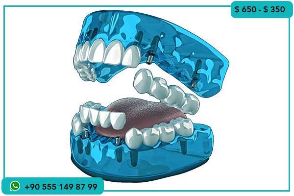 الفرق بين أسعار زراعة الأسنان في تونس وتركيا, زراعة الأسنان في تركيا, زراعة الأسنان في تونس, مقارنة تكاليف زراعة الأسنان, تكاليف زراعة الأسنان في تركيا, تكاليف زراعة الأسنان في تونس, أسباب اختيار تركيا لزراعة الأسنان, زراعة الأسنان بأسعار منخفضة, زراعة الأسنان بتقنيات متطورة, السياحة العلاجية في تركيا, أفضل عيادات زراعة الأسنان في تركيا, تجارب زراعة الأسنان في تركيا, مركز تجميل اسطنبول الدولي, زراعة الأسنان All-on-4, زراعة الأسنان الفورية, نجاح زراعة الأسنان , زراعة الأسنان, تكاليف زراعة الأسنان, الفرق بين تونس وتركيا, زراعة الأسنان في تركيا, تجارب المرضى, مركز تجميل اسطنبول الدولي, السياحة العلاجية, تقنيات زراعة الأسنان, جودة زراعة الأسنان, أسعار زراعة الأسنان, زراعة الأسنان All-on-4, تركيا الوجهة المثالية لزراعة الأسنان, زراعة الأسنان الفورية , لماذا زراعة الأسنان أرخص في تركيا, الفرق بين زراعة الأسنان في تونس وتركيا, ما هي تقنيات زراعة الأسنان في تركيا, كيف أختار أفضل عيادة لزراعة الأسنان في تركيا, لماذا يفضل الناس زراعة الأسنان في تركيا, كم تكلف زراعة الأسنان في تركيا, تجارب ناجحة لزراعة الأسنان في تركيا, كيف تتم زراعة الأسنان All-on-4, هل زراعة الأسنان مؤلمة, متى أحتاج لزراعة الأسنان, كيفية العناية بعد زراعة الأسنان, أفضل عيادات زراعة الأسنان في تركيا, ما هي السياحة العلاجية