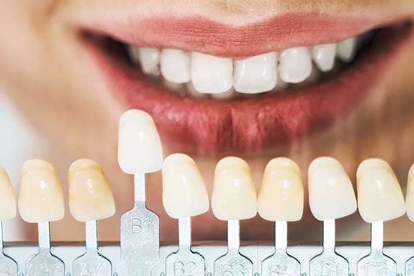 Hollywood Smile en Turquía precio, mejor clínica para Hollywood Smile en Turquía, cuánto cuesta la sonrisa de Hollywood en Turquía, carillas dentales en Turquía, implantes dentales en Turquía, blanqueamiento dental en Turquía, mejor dentista en Turquía para Hollywood Smile, ortodoncia invisible en Turquía, turismo dental en Turquía, costo Hollywood Smile Turquía vs EE.UU., paquetes de odontología estética en Turquía, diseño digital de sonrisa en Turquía, cómo conseguir la sonrisa de Hollywood en Turquía, mejores clínicas dentales en Estambul, Turquía Hollywood Smile opiniones , Hollywood Smile, sonrisa de Hollywood, Turquía, carillas dentales, blanqueamiento dental, implantes dentales, odontología estética, diseño de sonrisa, turismo dental, dentistas en Turquía, Estambul, tratamiento dental, salud dental, estética dental, ortodoncia invisible, clínicas dentales, costo Hollywood Smile, procedimiento dental, carillas de porcelana, carillas de composite , ¿Vale la pena hacerse Hollywood Smile en Turquía?, ¿Cuánto cuesta la sonrisa de Hollywood en Turquía?, ¿Cuáles son las mejores clínicas para Hollywood Smile en Turquía?, ¿Es seguro hacer turismo dental en Turquía?, ¿Cómo encontrar un buen dentista en Turquía?, ¿Qué incluye el procedimiento de Hollywood Smile?, ¿Cuánto duran las carillas dentales?, ¿Son mejores las carillas de porcelana o composite?, ¿Qué cuidados requiere la Hollywood Smile?, ¿Es Turquía un buen destino para tratamientos dentales?