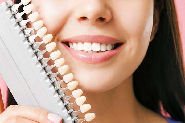 Faccette Dentali Turchia Opinioni