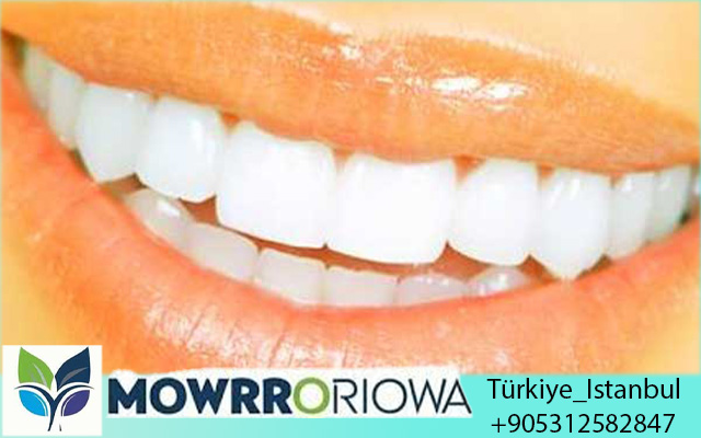 Cure Dentali in Turchia a Prezzi Convenienti 2025: Guida Completa per Pazienti Italiani | Risparmia Fino al 75%
