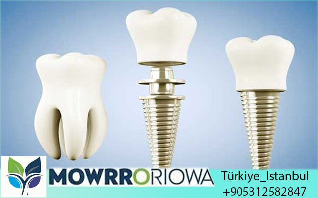 Sicurezza delle Cure Dentali in Turchia