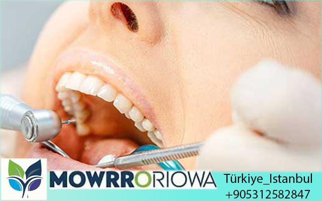 Miglior Dentista in Turchia per Italiani