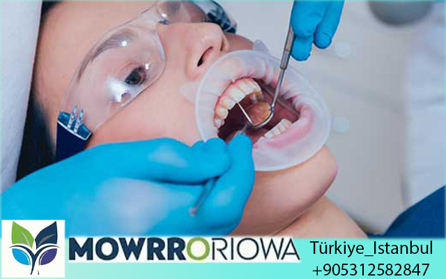 Impianto Dentale Completo in Turchia: La Guida Definitiva 2026 per Italiani